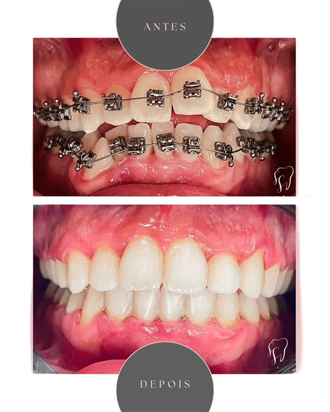 Antes e depois - Foto 03